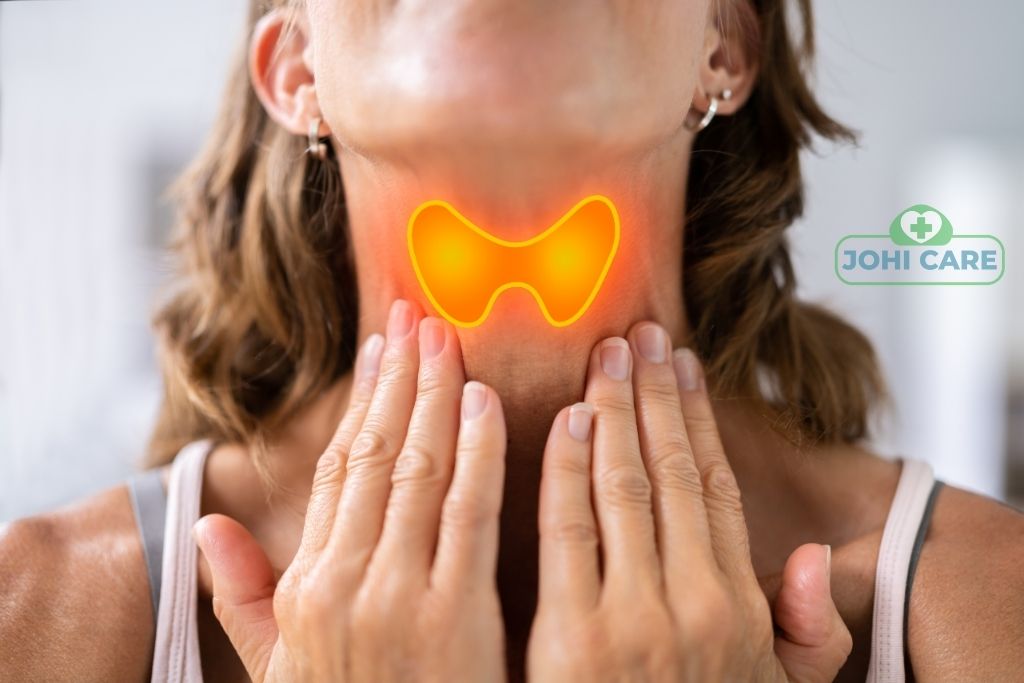 Thyroid treatment in homeopathy